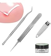 Ingrown Toe Nail Correction Set, Nail Correction Pad, Nail Clipper Ingrown Toenail Lifter and Twe...