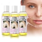 3 Pack Yellow Peeling Oil